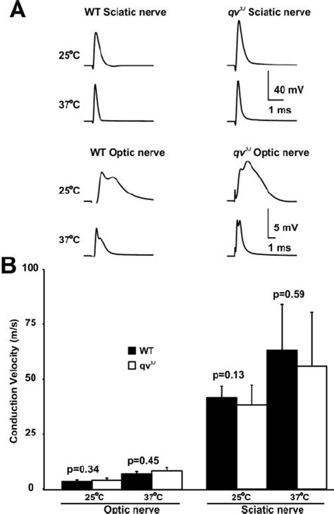 Compound Action Potentials From Pns And Cns Nerves In Qv J Mice A Download Scientific