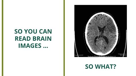 What Can Brain Scans Show Brac