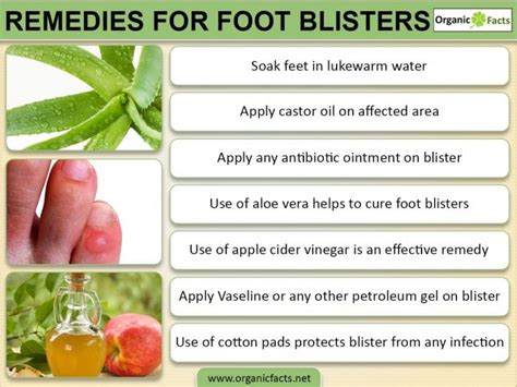 Home Remedies For Foot Blisters Organic Facts