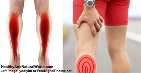 Effective Treatments For Pulled Strained Or Torn Calf Muscle