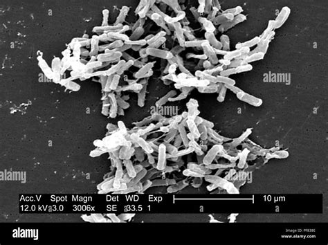Clostridium Difficile Sem Hi Res Stock Photography And Images Alamy