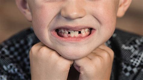 Smile Breakers 10 Everyday Habits That Messed Up Your Teeth