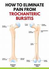 Images of Exercises Hip Bursitis