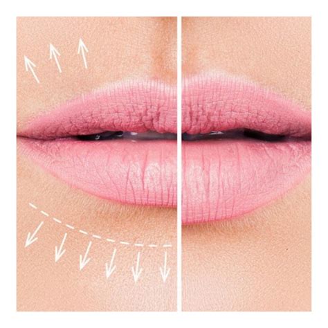 The Lip Flip Botox And Dermal Fillers Face Clinic Halifax