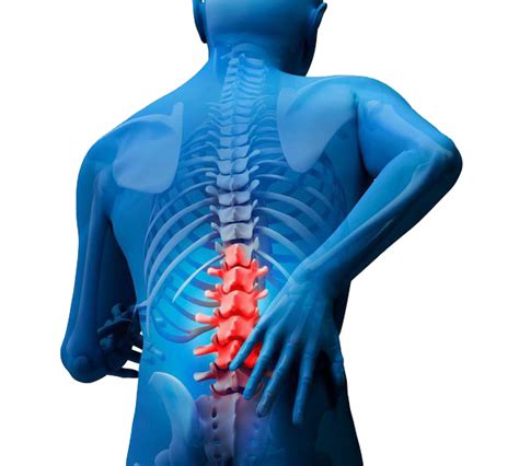 Musculoskeletal Back Pain Png Photo Png Arts