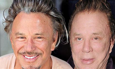 Mickey Rourke Face What Happened To Mickey Rourke S Face Is He Alright