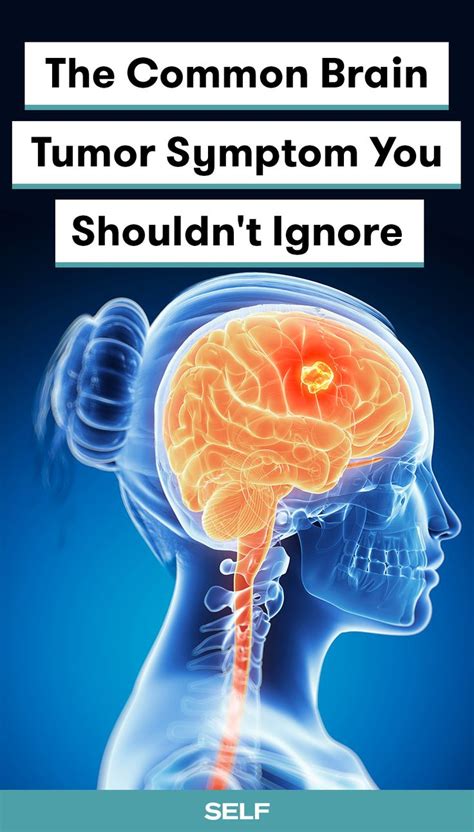 The Common Brain Tumor Symptom You Shouldnt Ignore Brain Tumor