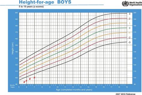 Height-for-age clinical growth chart for the second patient ...