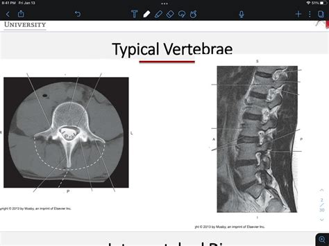 Typical Vertebrae Slides Cross Sectional Diagram Quizlet