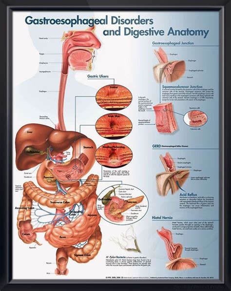 Gastroesophageal Disorders Anatomy Poster For Medical Office And