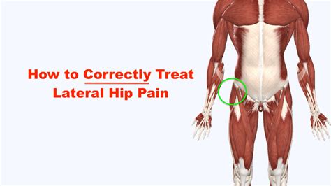 Fixing Lateral Hip Pain Squat University Hip Bursitis Exercises