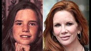 Melissa Gilbert Plastic Surgery Before and After - YouTube