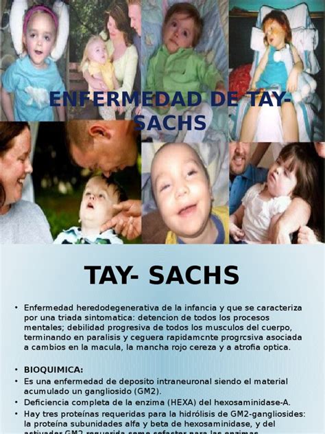 We did not find results for: Enfermedad de Tay Sachs | Enfermedades y trastornos ...