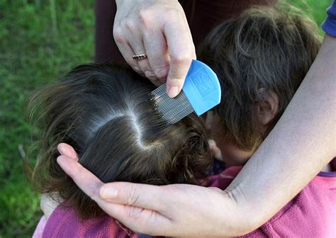 scott co mom arrested after 4 year old nearly dies from lice infestation wibc 93 1 fm