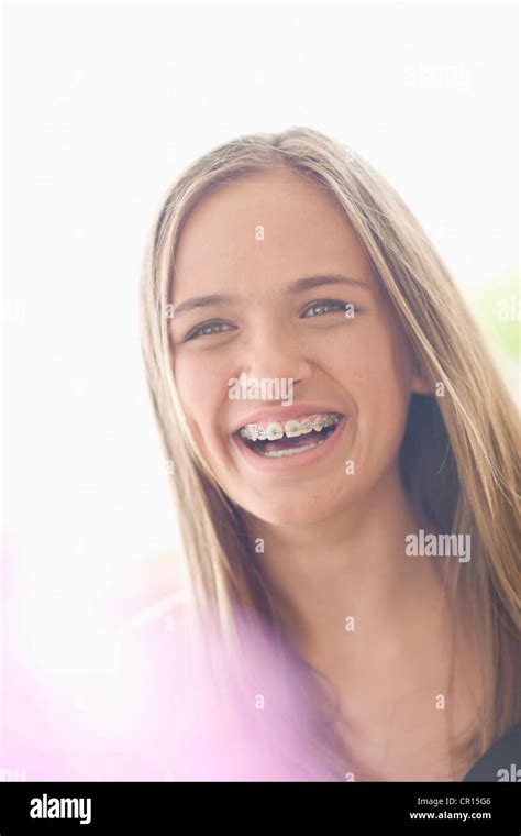 Close Up Of Teenage Girl In Braces Stock Photo Alamy