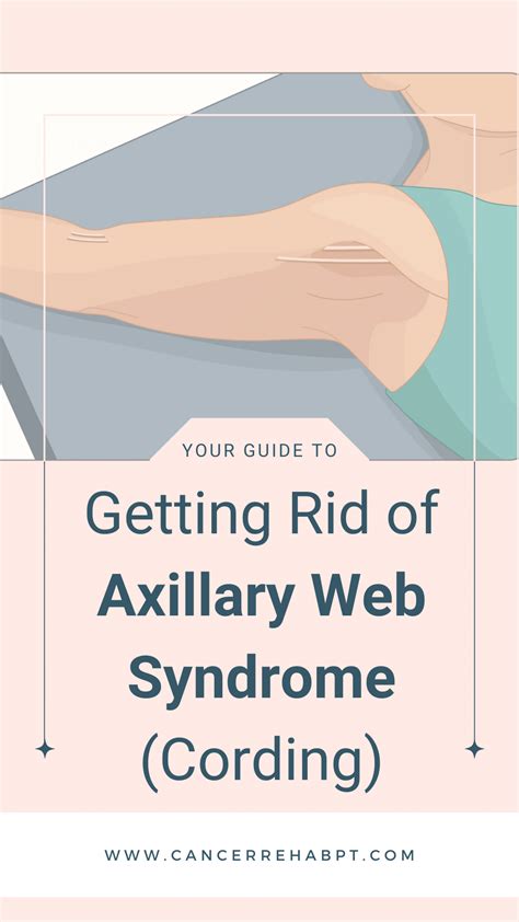 Cancer Rehab Pt — Your Guide To Getting Rid Of Axillary Web Syndrome