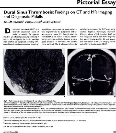 Dural Sinus Thrombosis Findings On Ct And Mr Imaging And Diagnostic Pitfalls Ajr