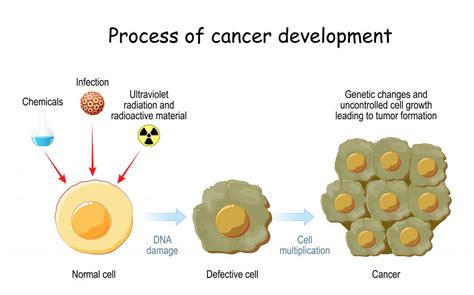 What If We Understood The Genetic Causes Of Cancer Futurum