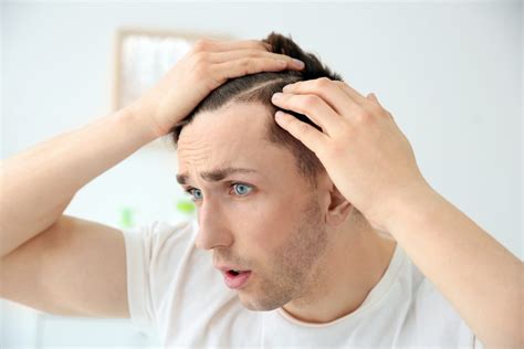 Hair Loss Prevention For Men
