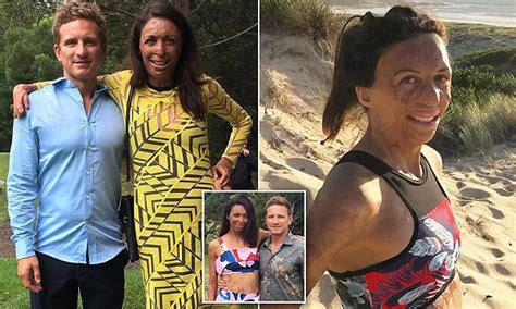 Burns Survivor Turia Pitt Opens Up About Her Fianc Daily Mail Online