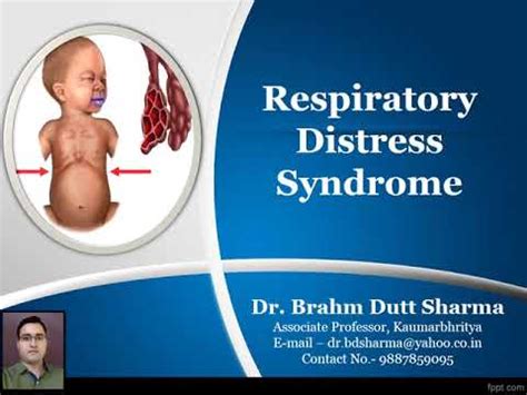 Respiratory Distress Syndrome Hyaline Membrane Disease Rds Ards