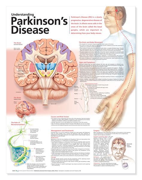 The pathophysiology is at present better understood with plurifactorial etiology, including genetic predisposition and environmental toxic factors. Understanding Parkinson's Disease Anatomical Chart, 2nd ...