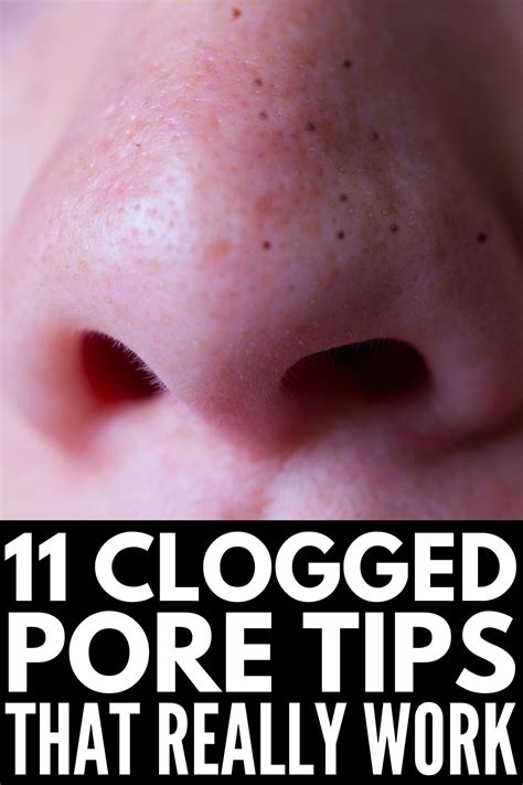 How To Get Rid Of Clogged Pores 11 Remedies Products We Swear By Artofit