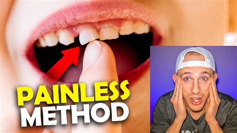 How To Pull Out A Tooth Without Pain Orthodontist Reacts Youtube
