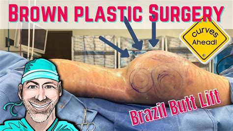 Brazil Butt Lift Surgery Surgeon Pov Youtube