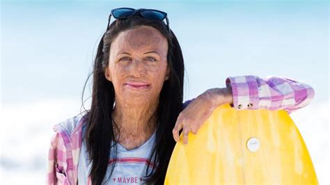 Turia Pitt Journey Back To Her First Love Of Surfing