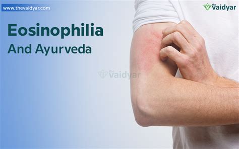 Symptoms And Causes Of Eosinophilia