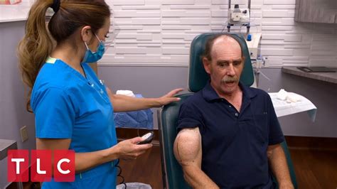Chuck Has A Popeye Shaped Bump On His Arm Dr Pimple Popper Youtube