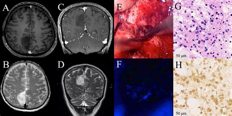 Illustrative Clinical Course Of A Patient With Absence Of Visible