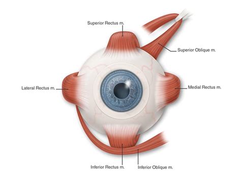 Microvascular Cranial Nerve Palsy South Bay Ophthalmology