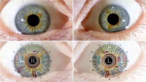Iridology The Science Of The Eye The Galactic Travel Channel