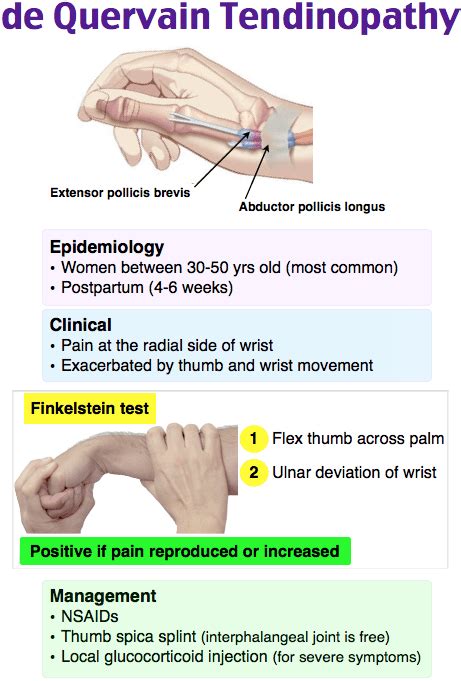 The main symptom of de quervain's tenosynovitis is pain or tenderness at the base of your thumb. Rapid Review: de Quervain Tenosynovitis - RoshReview.com