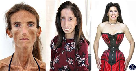 Thinnest Woman In The World 3 Impressive Stories Legitng