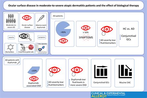 Ocular Surface Disease In Moderate‐to‐severe Atopic Dermatitis Patients