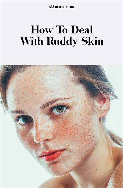 Treat Ruddy Skin And Redness In 4 Steps Powered By L