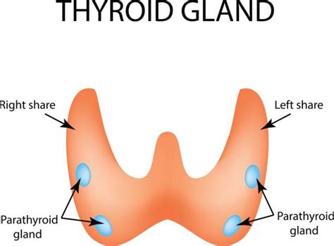 Hypothyroidism Illustrations Royalty Free Vector Graphics And Clip Art