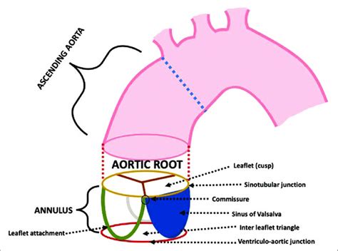 Representation Of The Aortic Root And Its Components The Most Widely