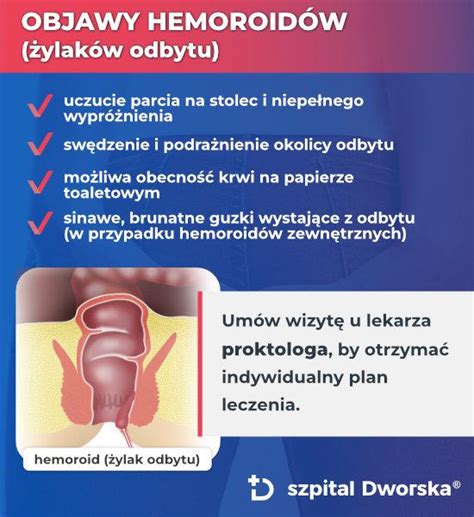 Hemoroidy Szpital Dworska