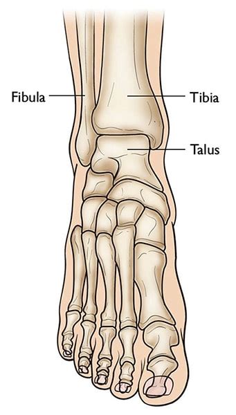 Pilon Fractures Of The Ankle Orthoinfo Aaos