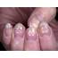 What Your Nails Say About Health  Boldskycom