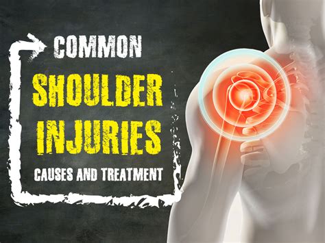 Common Shoulder Injuries Causes And Treatment