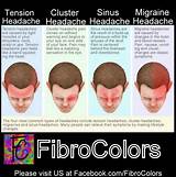 Pictures of Sinus Migraine Treatment