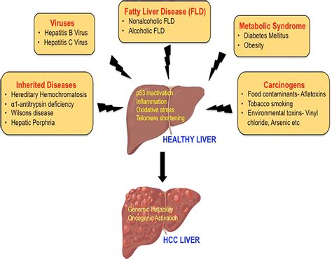 Diagram Of Liver Cirrhosis Stage Disease Of The Liver Arrows Indicate