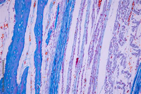 Human Hyaline Cartilage Bone Under Microscope Foto De Stock Hot Sex