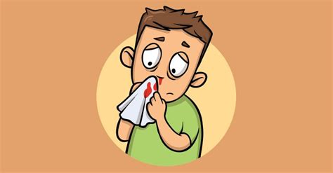 Nosebleed Why It Happens And How To Treat It Nmami Life