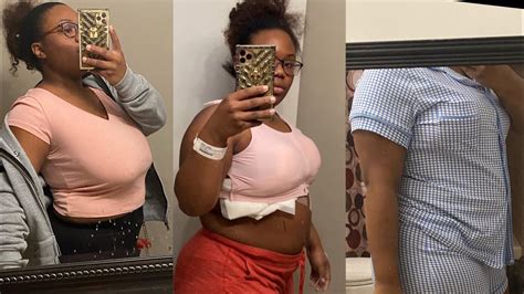 Breast Reduction Surgery Vlog Day 1 4 First Video Youtube